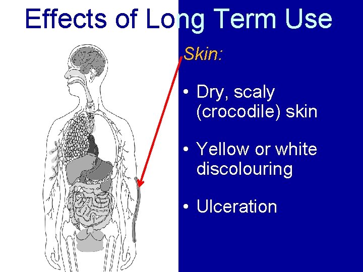 Effects of Long Term Use Skin: • Dry, scaly (crocodile) skin • Yellow or