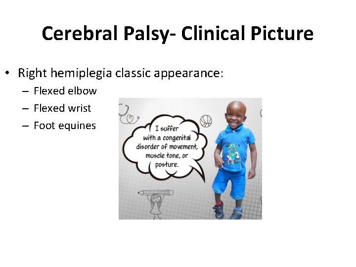 Cerebral Palsy- Clinical Picture • Right hemiplegia classic appearance: – Flexed elbow – Flexed Cerebral Palsy- Clinical Picture • Right hemiplegia classic appearance: – Flexed elbow – Flexed