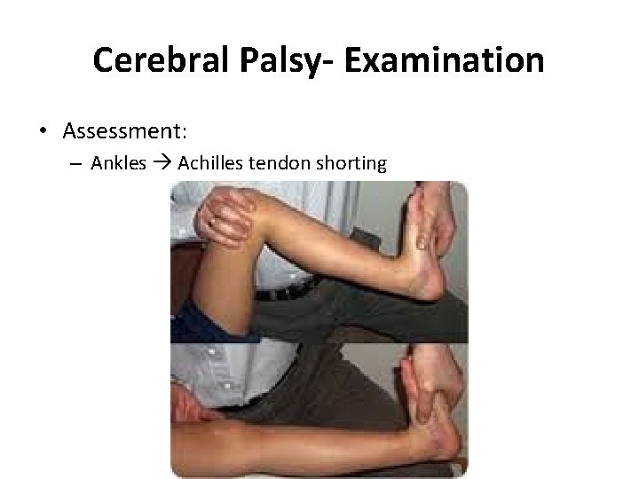 Cerebral Palsy- Examination • Assessment: – Ankles Achilles tendon shorting Cerebral Palsy- Examination • Assessment: – Ankles Achilles tendon shorting