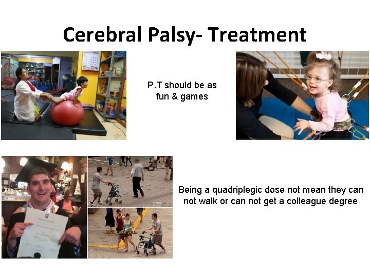 Cerebral Palsy- Treatment P. T should be as fun & games Being a quadriplegic Cerebral Palsy- Treatment P. T should be as fun & games Being a quadriplegic
