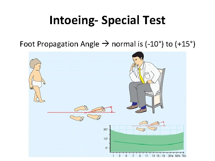 Intoeing- Special Test Foot Propagation Angle normal is (-10°) to (+15°) Intoeing- Special Test Foot Propagation Angle normal is (-10°) to (+15°)