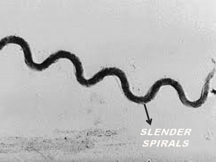 SLENDER SPIRALS 