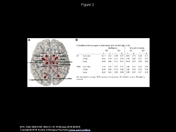 Figure 2 BPS: CNNI 2020 5152 -162 DOI: (10. 1016/j. bpsc. 2019. 004) Copyright