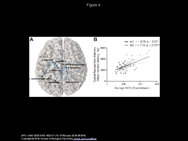 Figure 4 BPS: CNNI 2020 5152 -162 DOI: (10. 1016/j. bpsc. 2019. 004) Copyright