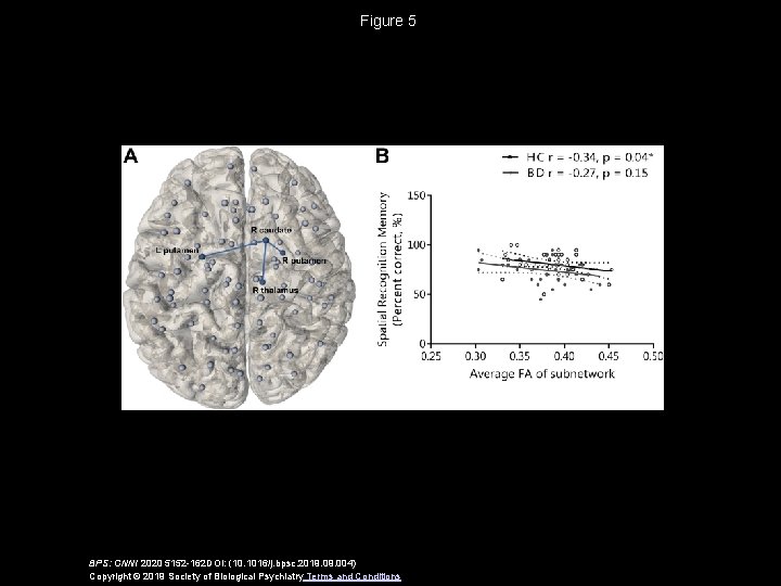 Figure 5 BPS: CNNI 2020 5152 -162 DOI: (10. 1016/j. bpsc. 2019. 004) Copyright