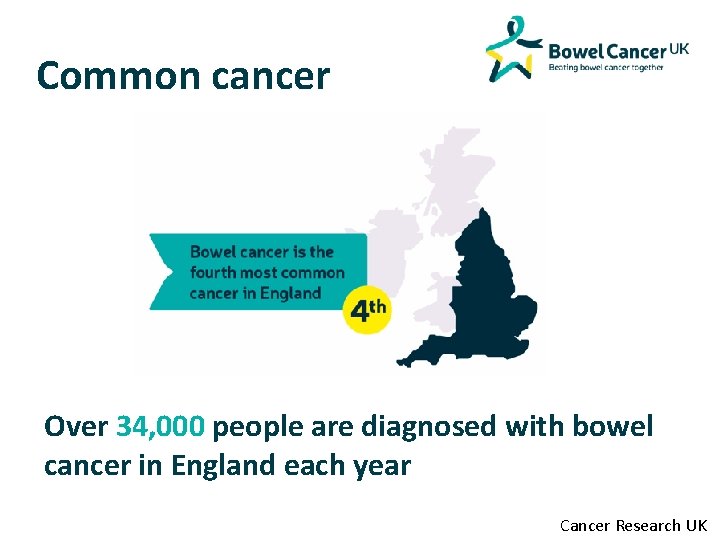 Common cancer Over 34, 000 people are diagnosed with bowel cancer in England each