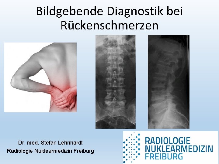 Bildgebende Diagnostik bei Rückenschmerzen Dr. med. Stefan Lehnhardt Radiologie Nuklearmedizin Freiburg 