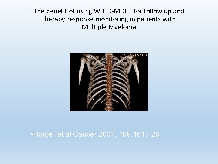 The benefit of using WBLD-MDCT for follow up and therapy response monitoring in patients