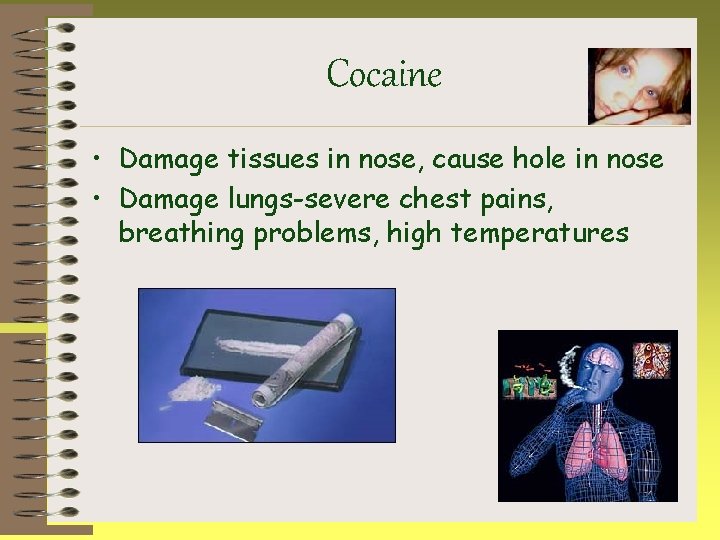 Cocaine • Damage tissues in nose, cause hole in nose • Damage lungs-severe chest