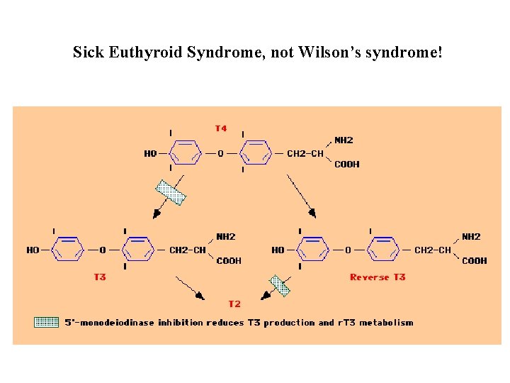 Sick Euthyroid Syndrome, not Wilson’s syndrome! 