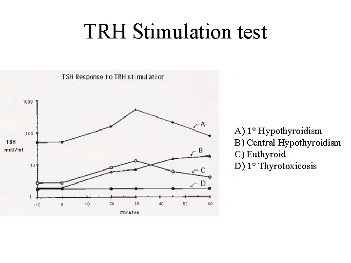 TRH Stimulation test A) 1° Hypothyroidism B) Central Hypothyroidism C) Euthyroid D) 1° Thyrotoxicosis