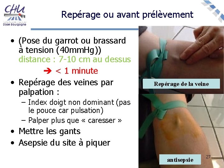 Repérage ou avant prélèvement • (Pose du garrot ou brassard à tension (40 mm.