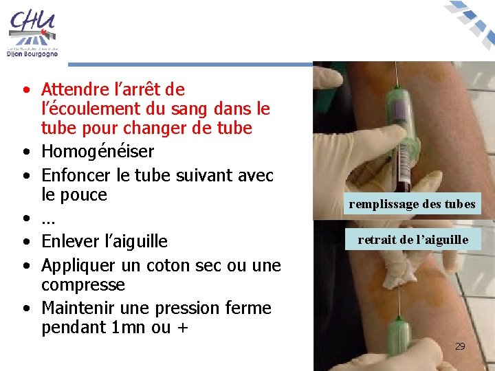  • Attendre l’arrêt de l’écoulement du sang dans le tube pour changer de