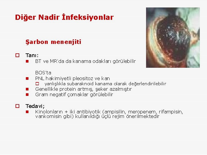 Diğer Nadir İnfeksiyonlar Şarbon menenjiti o Tanı: n n o BT ve MR’da da