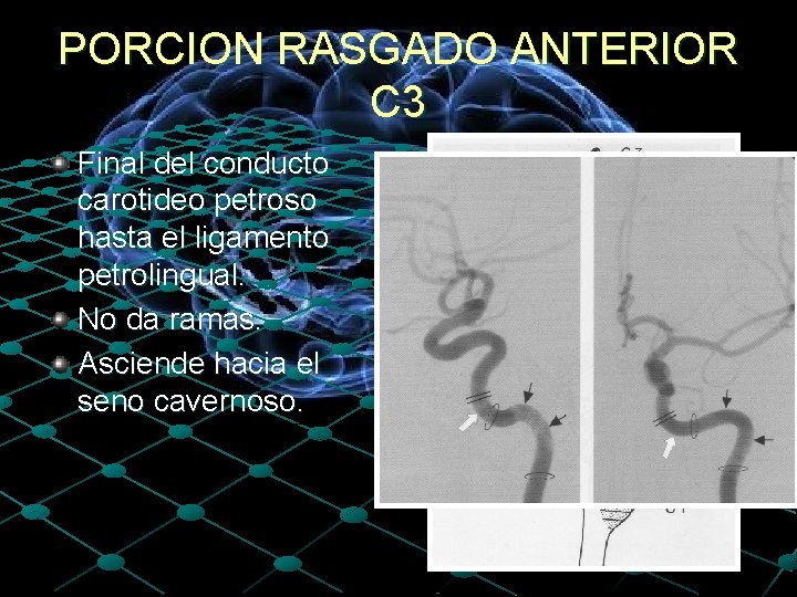 PORCION RASGADO ANTERIOR C 3 Final del conducto carotideo petroso hasta el ligamento petrolingual.