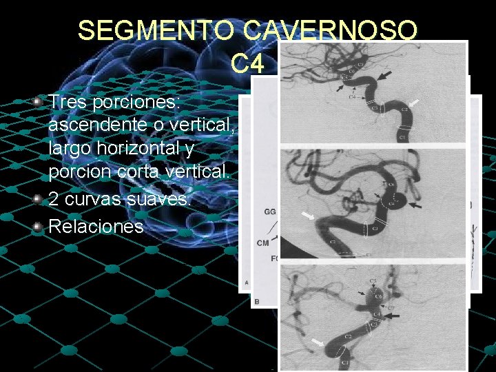 SEGMENTO CAVERNOSO C 4 Tres porciones: ascendente o vertical, largo horizontal y porcion corta
