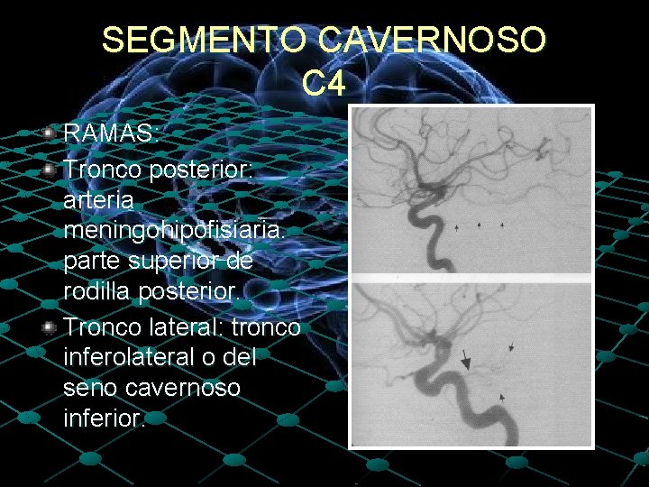 SEGMENTO CAVERNOSO C 4 RAMAS: Tronco posterior: arteria meningohipofisiaria. parte superior de rodilla posterior.