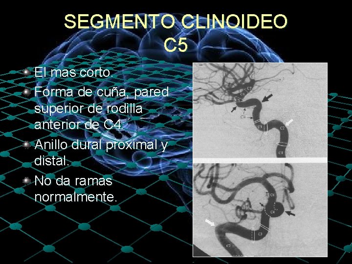 SEGMENTO CLINOIDEO C 5 El mas corto. Forma de cuña, pared superior de rodilla