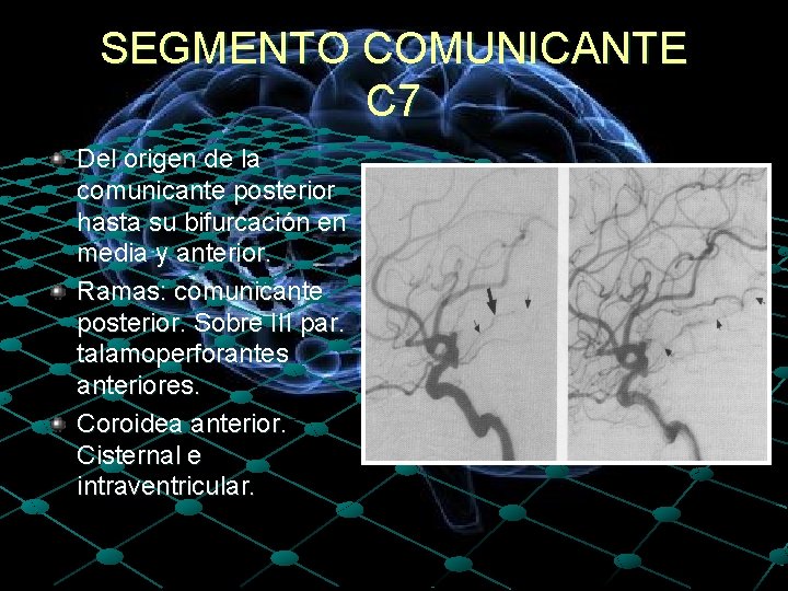 SEGMENTO COMUNICANTE C 7 Del origen de la comunicante posterior hasta su bifurcación en