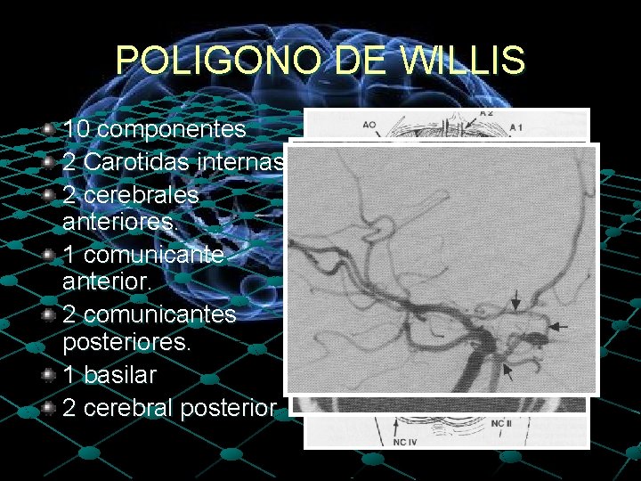 POLIGONO DE WILLIS 10 componentes 2 Carotidas internas. 2 cerebrales anteriores. 1 comunicanterior. 2