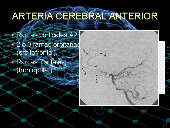 ARTERIA CEREBRAL ANTERIOR Ramas corticales A 2: 2 o 3 ramas orbitarias (orbitofrontal). Ramas