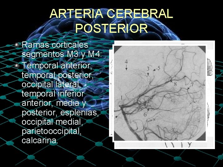 ARTERIA CEREBRAL POSTERIOR Ramas corticales segmentos M 3 y M 4: Temporal anterior, temporal