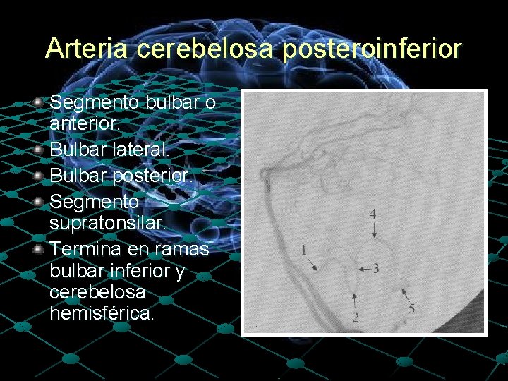 Arteria cerebelosa posteroinferior Segmento bulbar o anterior. Bulbar lateral. Bulbar posterior. Segmento supratonsilar. Termina