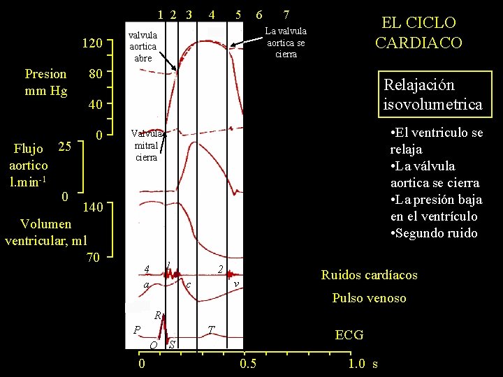 1 2 3 120 Presion mm Hg Flujo 25 aortico l. min-1 0 4