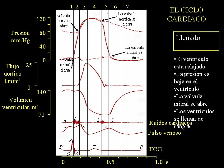 1 2 3 120 Presion mm Hg Flujo 25 aortico l. min-1 0 4
