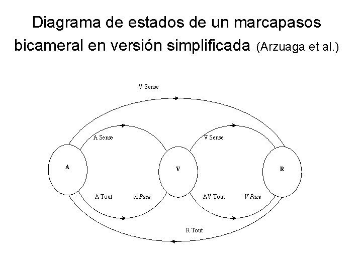 Diagrama de estados de un marcapasos bicameral en versión simplificada (Arzuaga et al. )