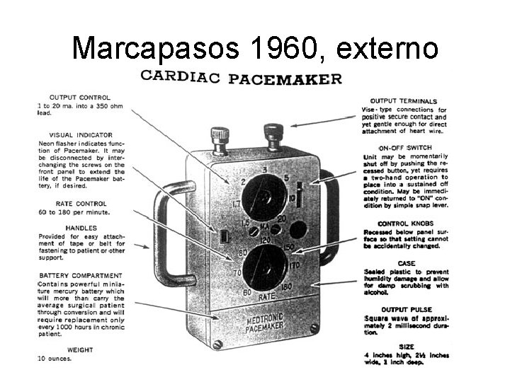 Marcapasos 1960, externo 