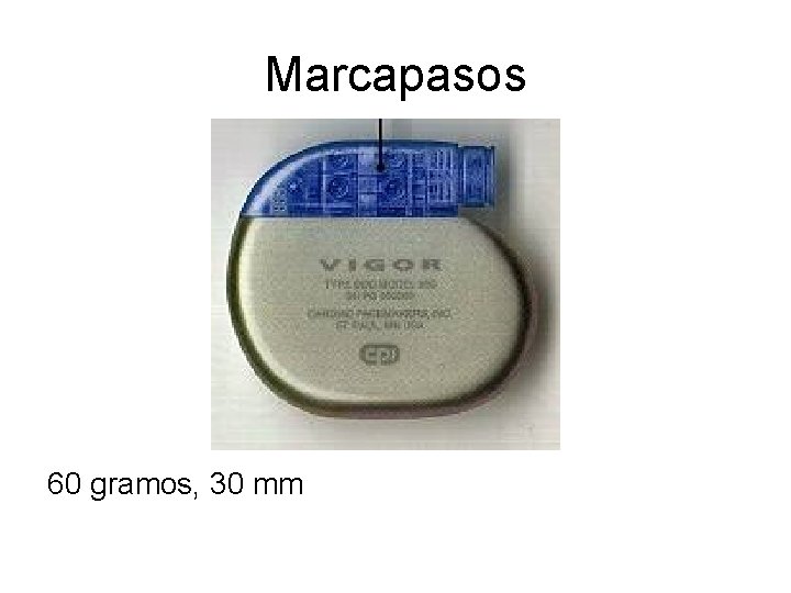 Marcapasos 60 gramos, 30 mm 