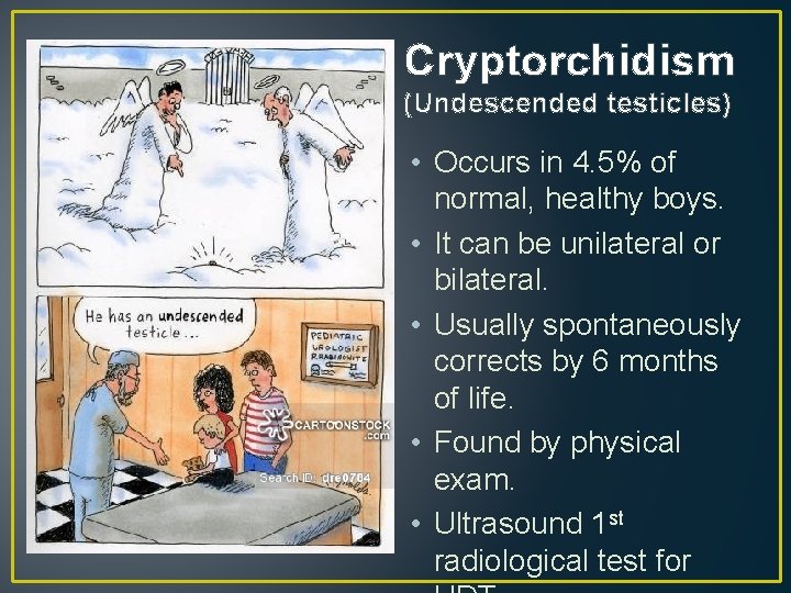 Cryptorchidism (Undescended testicles) • Occurs in 4. 5% of normal, healthy boys. • It