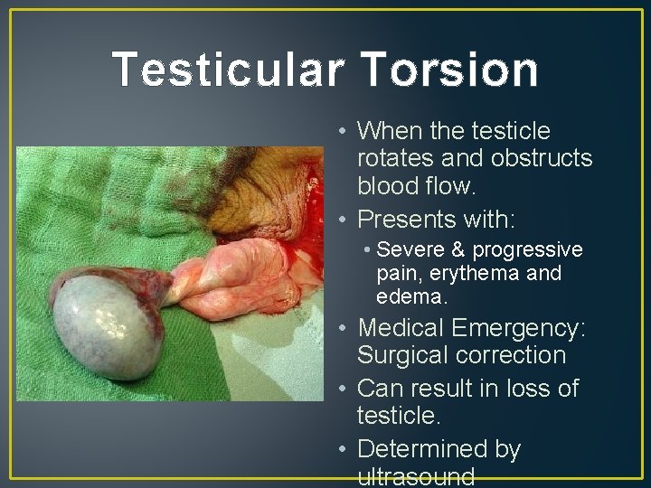 Testicular Torsion • When the testicle rotates and obstructs blood flow. • Presents with: