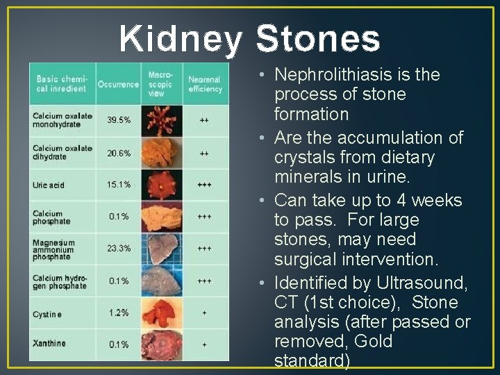 Kidney Stones • Nephrolithiasis is the process of stone formation • Are the accumulation