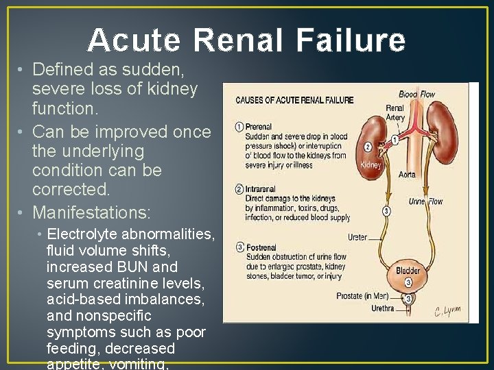 Acute Renal Failure • Defined as sudden, severe loss of kidney function. • Can