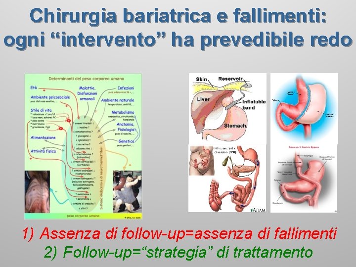 Chirurgia bariatrica e fallimenti: ogni “intervento” ha prevedibile redo 1) Assenza di follow-up=assenza di