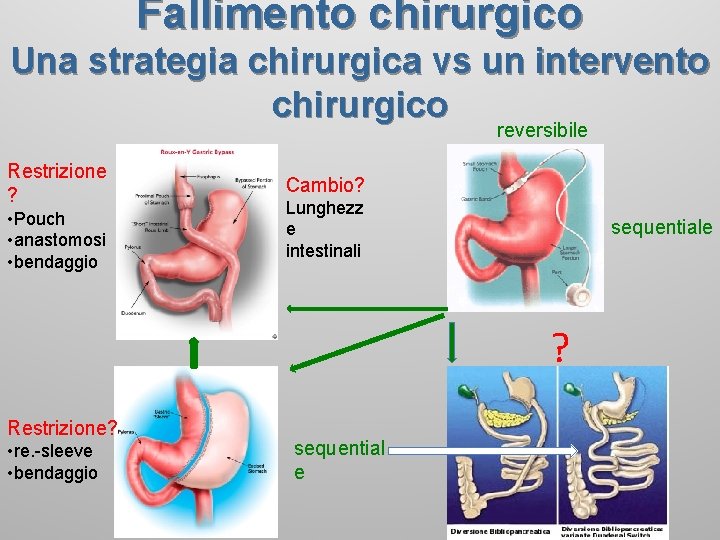 Fallimento chirurgico Una strategia chirurgica vs un intervento chirurgico reversibile Restrizione ? • Pouch