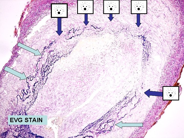 EVG STAIN 