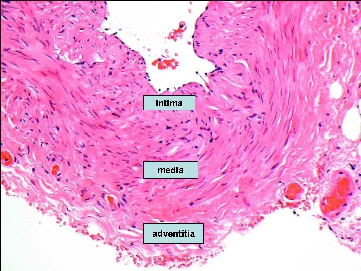 intima media adventitia 