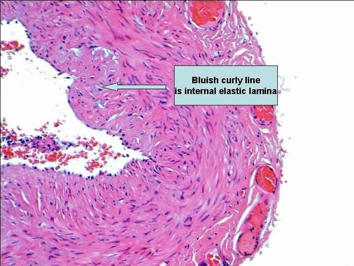 Bluish curly line is internal elastic lamina 