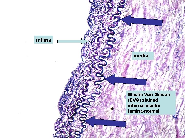 intima media Elastin Von Gieson (EVG) stained internal elastic lamina-normal. 