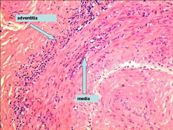 adventitia media 