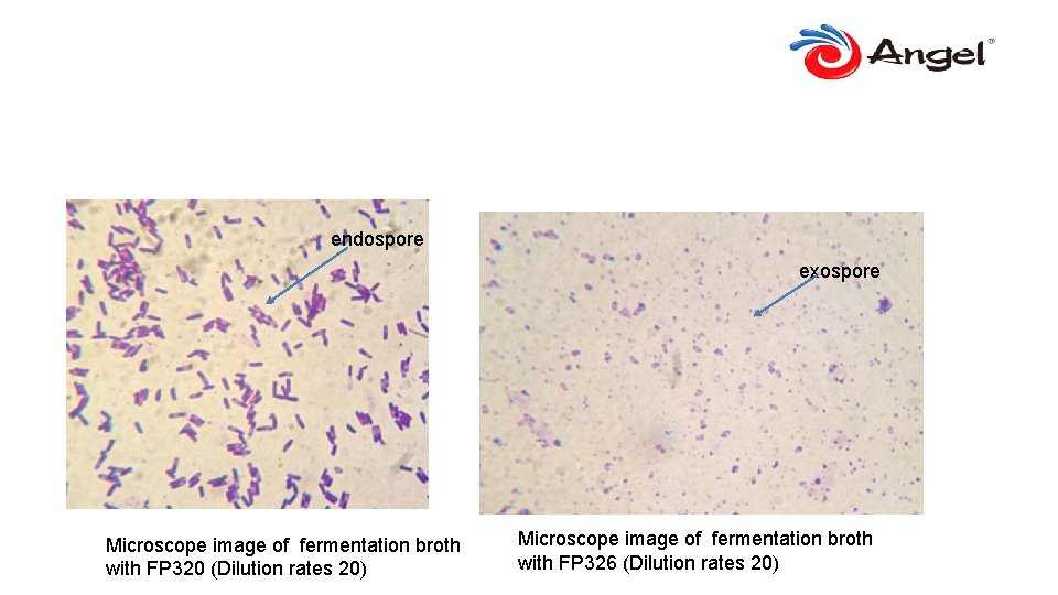 endospore exospore Microscope image of fermentation broth with FP 320 (Dilution rates 20) Microscope