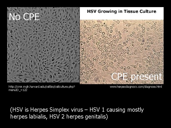 No CPE present http: //cmir. mgh. harvard. edu/cellbio/cellculture. php? menu. ID_=122 www. herpesdiagnosis. com/diagnose.