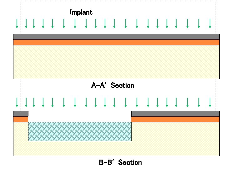 Implant A-A’ Section B-B’ Section 