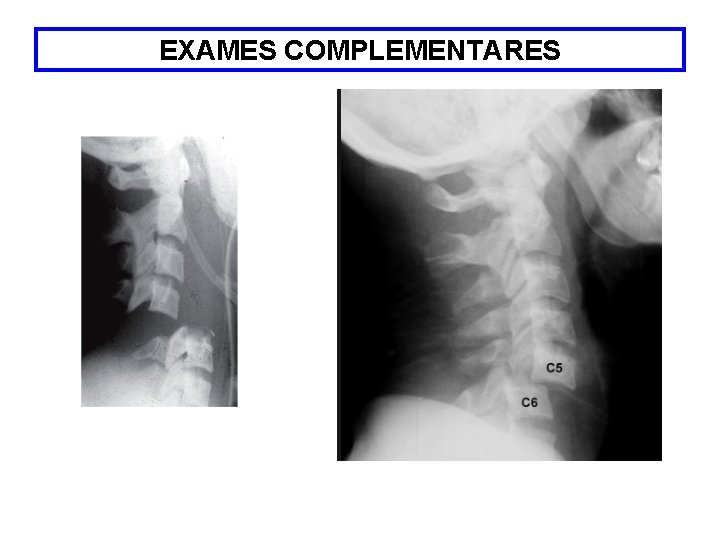 EXAMES COMPLEMENTARES 