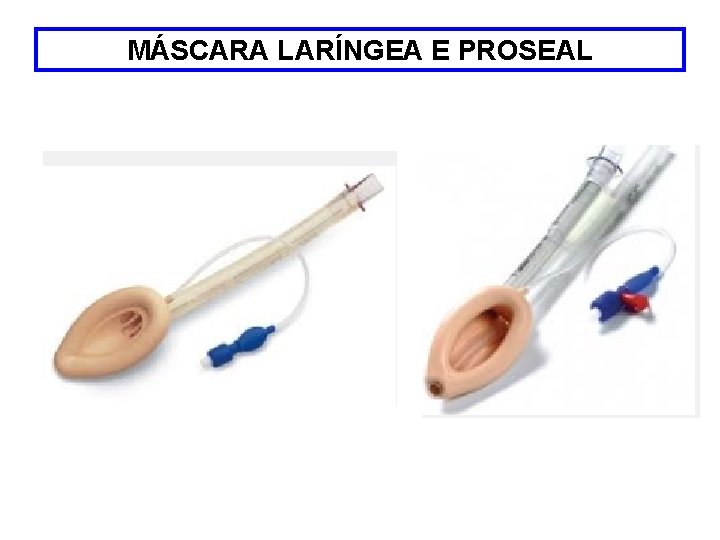 MÁSCARA LARÍNGEA E PROSEAL 