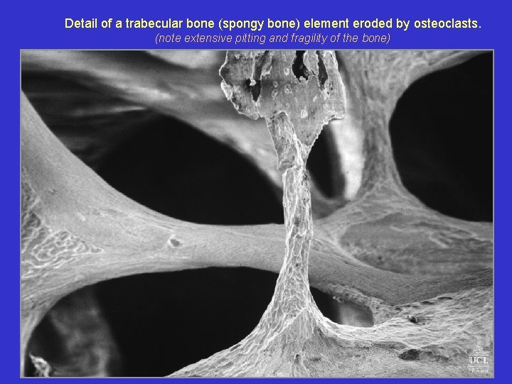 Detail of a trabecular bone (spongy bone) element eroded by osteoclasts. (note extensive pitting