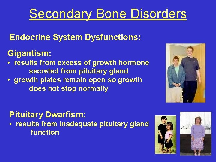 Secondary Bone Disorders Endocrine System Dysfunctions: Gigantism: • results from excess of growth hormone